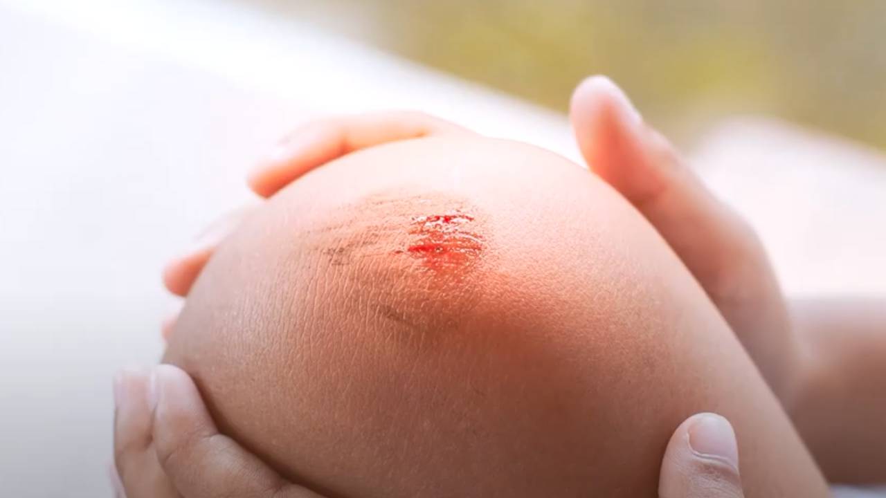 Çinko eksikliğinde vücutta neler olur? İşte çinko eksikliğinin belirtileri...