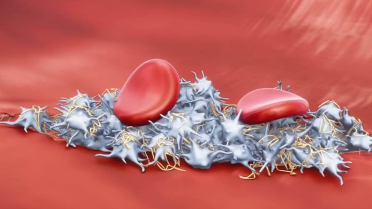 K vitamini neden önemlidir? K vitamini eksikliğinde ne olur?