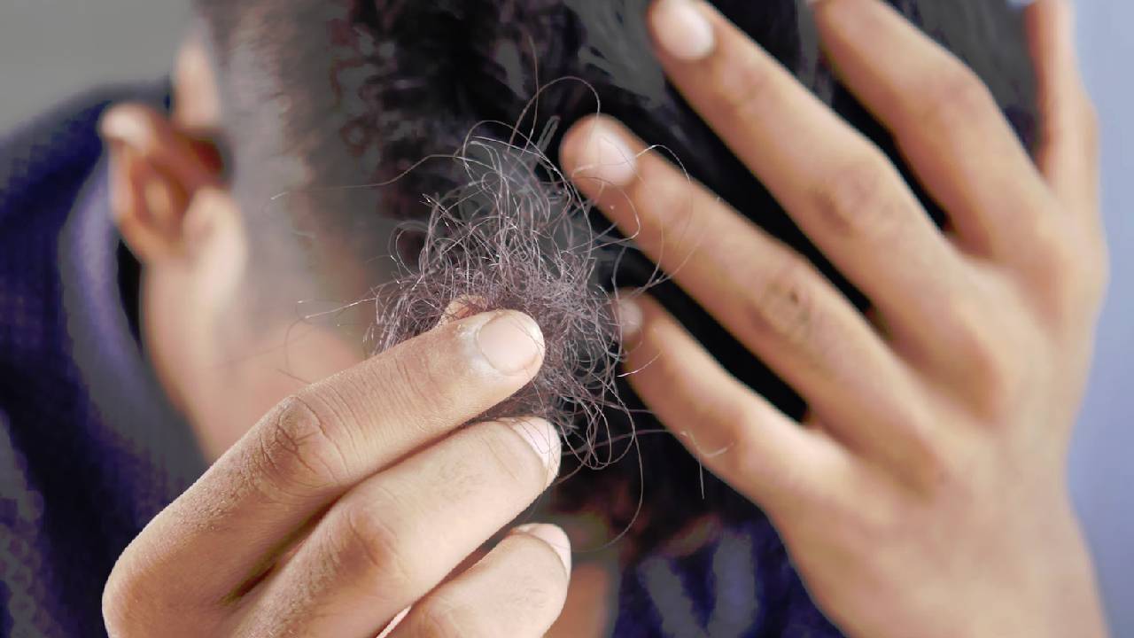 Saç dökülmesi için hangi vitaminler alınmalıdır?