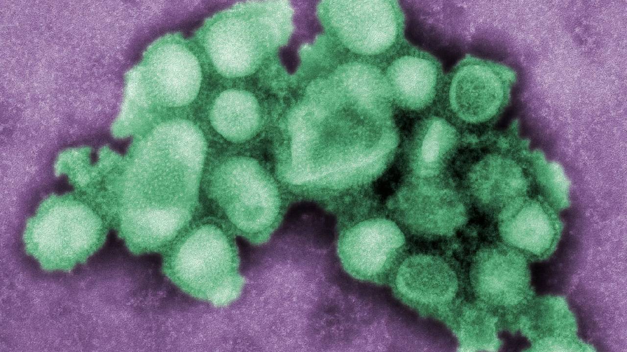 Koronavirüsün yeni rakibi domuz gribinin 8 belirtisi