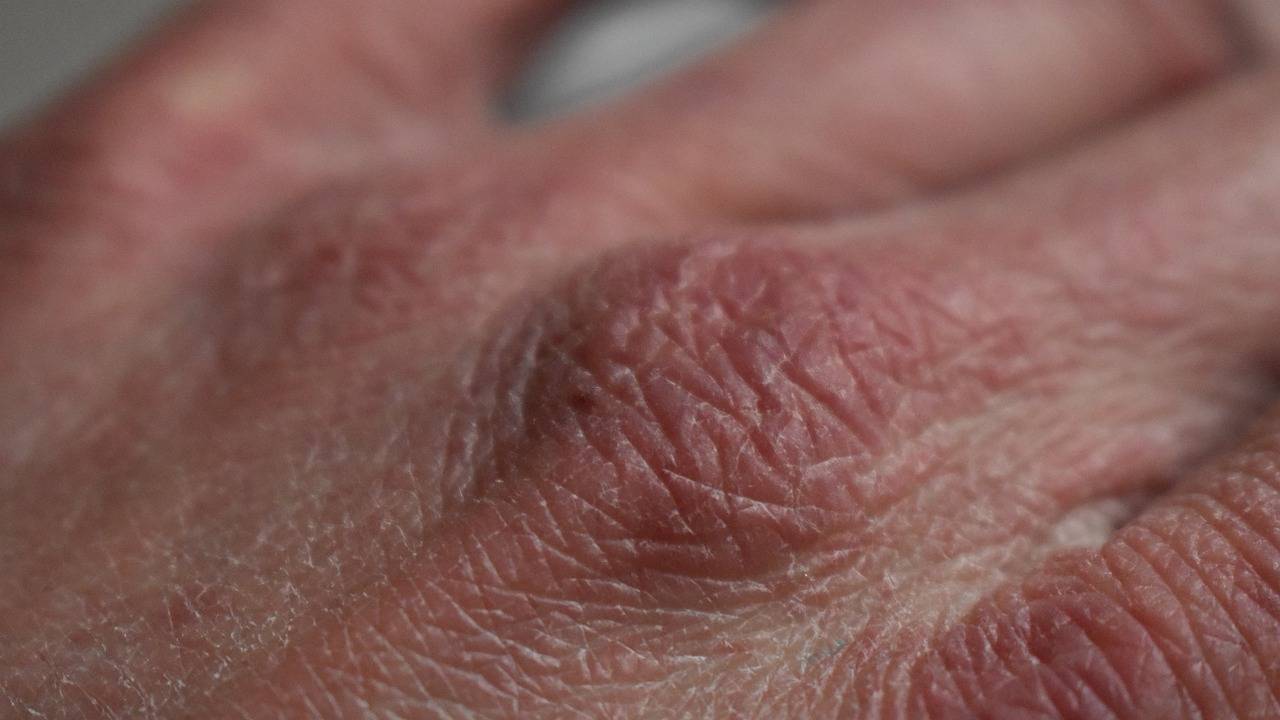 Kuru ve kaşıntılı bir cilt, ciddi bir durumun habercisi olabilir!