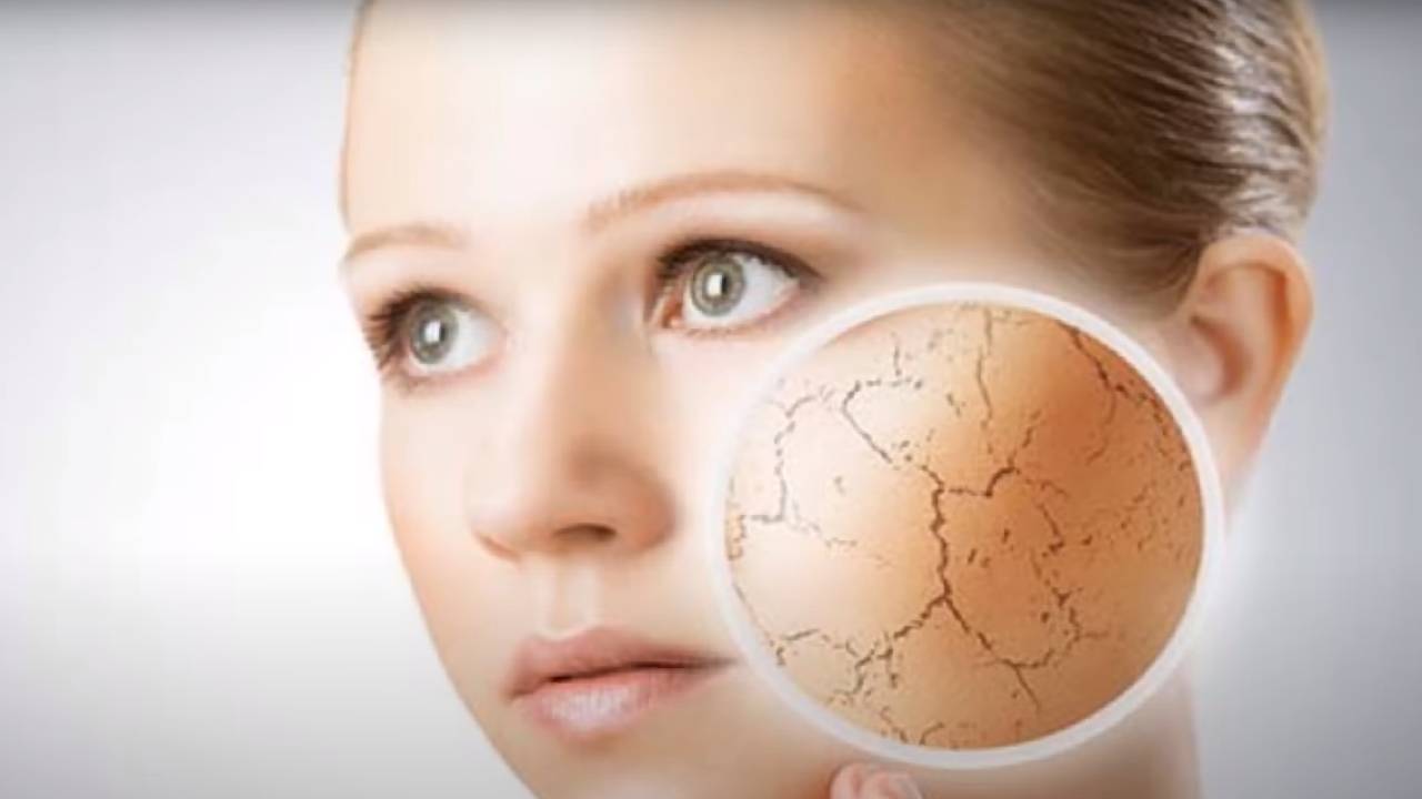 Bu yöntemler ciltteki kuruluğu yok ediyor! Kışın pürüzsüz bir cilt için...