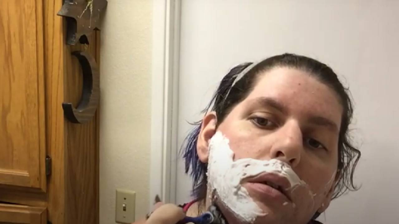 Aşırı kıllanma (Hirşutizm) nedir? Vücutta kıllanma artışı neden olur?