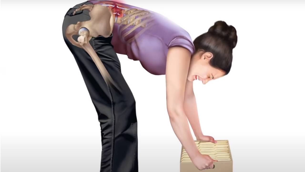 Bel ağrısına ne iyi gelir? Bel ağrısı nasıl geçer? İşte doğal yöntemler