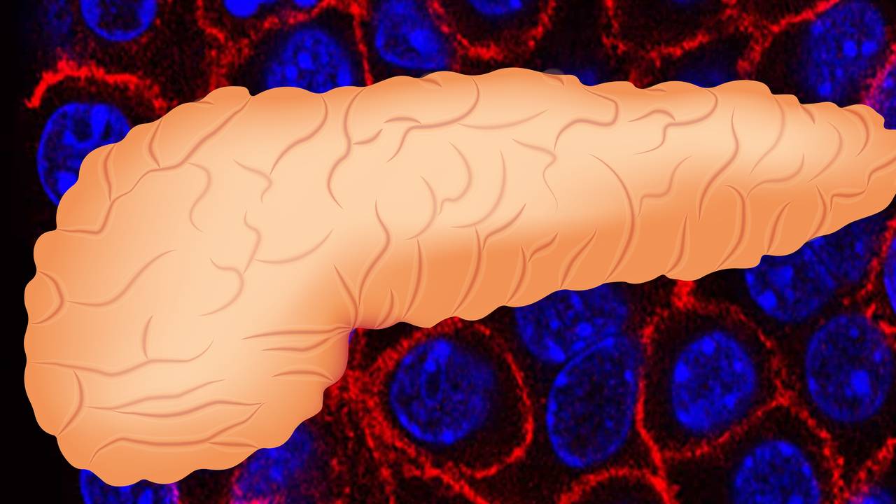 Pankreas kanserini önlemenin 3 yolu