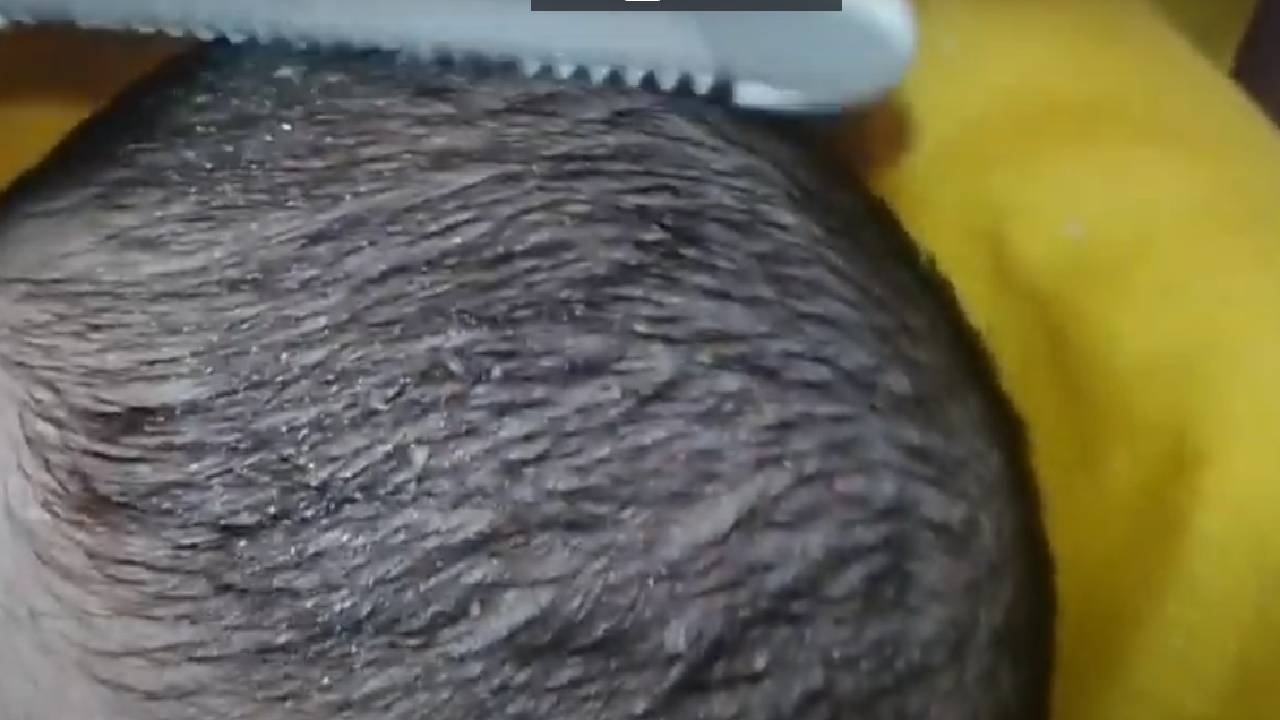 Eyvah Bebeğimde Konak Var! Bebeğimin Kafasındaki Konağı Nasıl Temizleyebilirim?